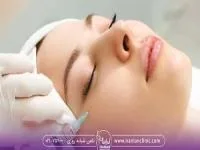 پروفایلو استراکچرا