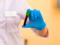 هموکروماتوز