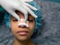 جراحی بینی و سینه محبوبترین عمل های زیبایی