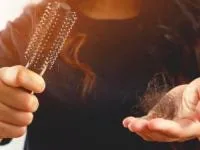 ویتامین ریزش مو