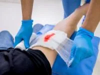روش قطع خونریزی