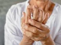 آرتریت روماتوئید
