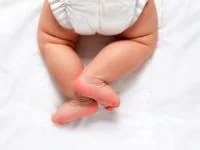عوارض پوشک بچه