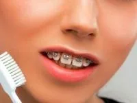 انواع مختلف ارتودنسی
