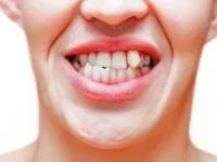 اوربایت