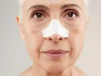 جوش های سرسیاه