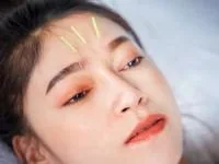 لیفتینگ صورت