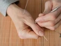 طب سوزنی برای درمان چاقی