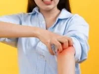 آلرژی های عجیب