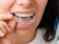 نایت گارد دندان