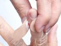 زخم و بریدگی