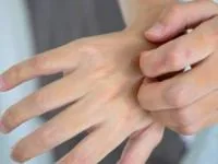 قارچ پوستی