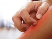 دور کردن پشه