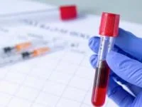 آزمایش ایدز