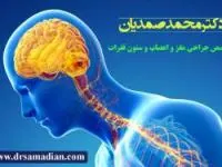تومور های مغزی
