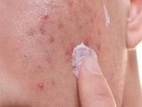 رسیدگی به پوست 