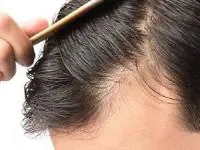 سلامت مو