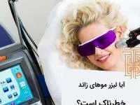 لیزر مو 
