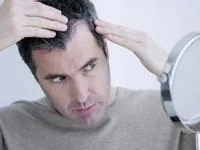 ریزش مو