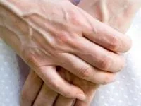 پیری دست 