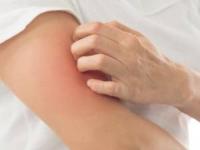 بیماری سلیاک