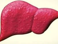 سیروز صفراوی
