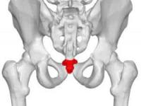 درد دنبالچه