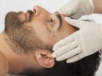 جراحی پلاستیک صورت