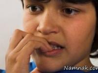 وسواس کندن پوست