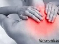 آرتروز گردن