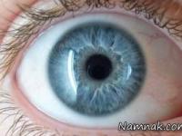 مسمومیت چشمی