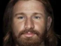 بازسازی چهره