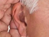 سندرم رامسی هانت
