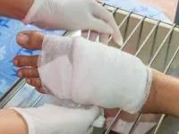 درمان قانقاریا