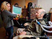 اسکلروز جانبی آمیوتروفیک