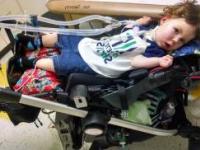 بیماری sma چیست