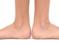 علت صافی کف پا