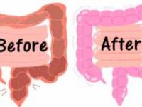 پاکسازی روده