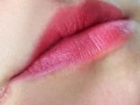 ترک گوشه لب