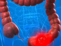 میکروب روده