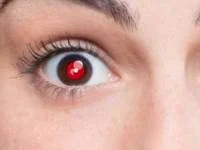 قرمزی چشم در عکس