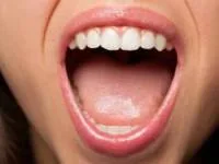 بیماری های دهان و دندان