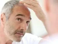 دارو بعد کاشت مو