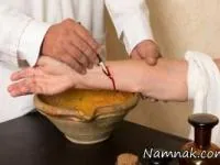 فصد خون