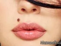 خال خطرناک