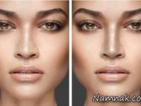 آرایش بینی قوزدار