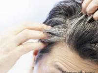 رنگ كردن مو مردان