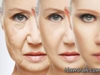 رفع چین و چروک