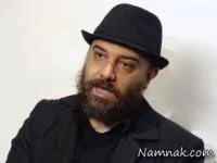 کاشت مو