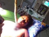 شاخه درخت در گلوی پسربچه